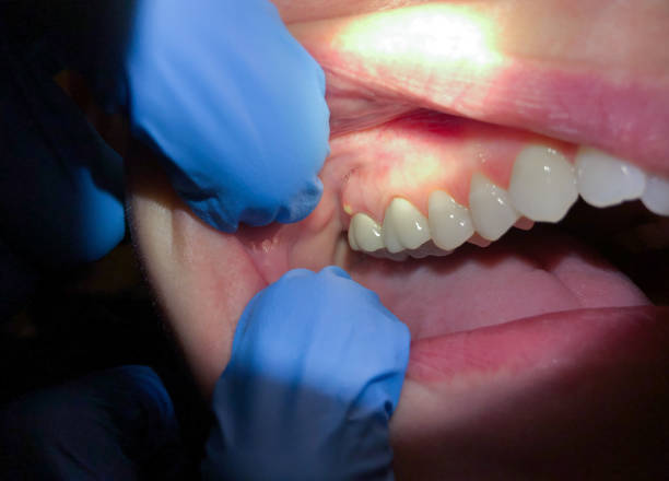 Best Pediatric Emergency Dentist in Ocean Springs, MS